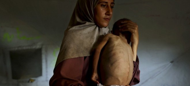 Trump: “Gazze’deki Durum Sona Ermek Zorunda, 2-3 Hafta İçinde Kesin Sonuç Görebiliriz”